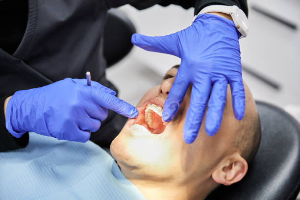 Best Emergency Dentist for Knocked-Out Tooth in Gautier, MS